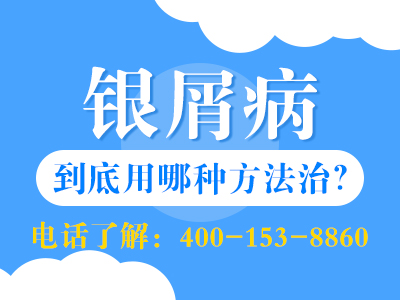 哈尔滨盛京医院治疗银屑病怎么样